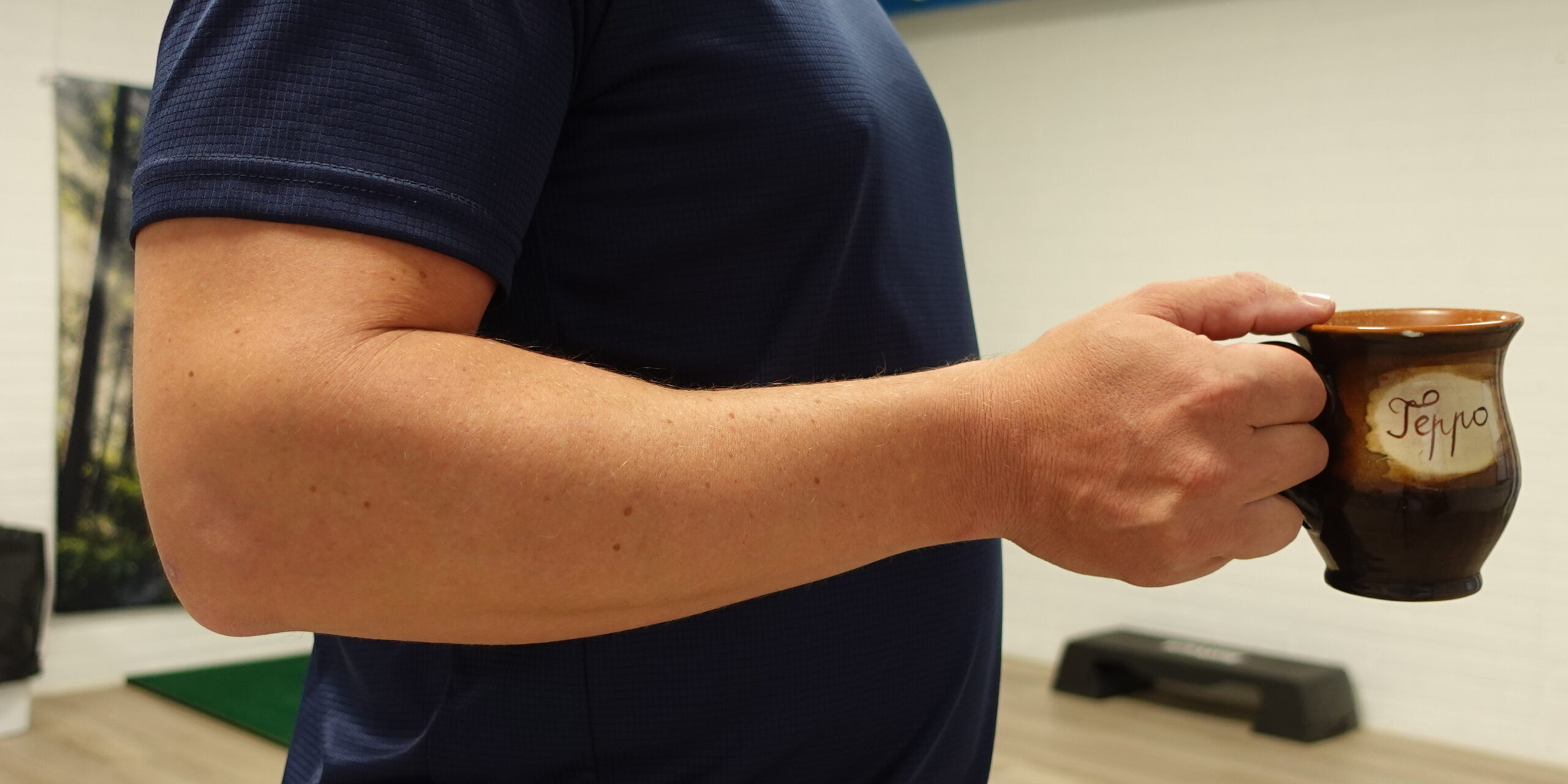 Kahvikupin nostaminen aiheuttaa kipua kyynärpään ulkosivulla – tenniskyynärpää fysioterapia Joensuu.