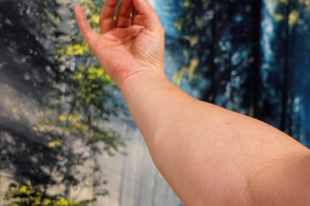 Fysioterapeutti Teppo Holopainen havainnollistaa sormien puutumista ja pistelyä jotka ovat tyypillisiä kaularangan hermopinteen oireita Reijolan Fysioterapiassa Joensuussa